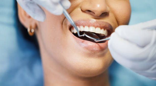 Best Knocked-Out Tooth Emergency  in Brea, CA